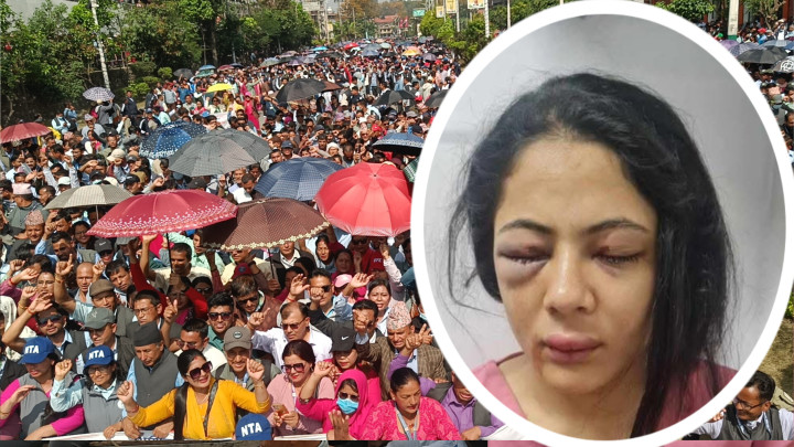 शिक्षक आन्दोलनको रिपोर्टिङका क्रममा पत्रकारमाथि आक्रमण : अनलाइन टिभी पत्रकार संघको खेद